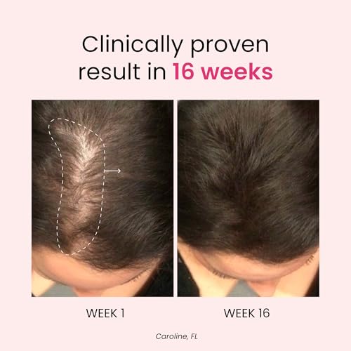 Anti-Stress & Hair Growth Gummies for Women | Sugar-Free, Vegan Hair Supplements | Gluten-Free, Soy-Free, Dairy-Free Gummy Vitamins for Thicker, Healthier Hair | 30 Servings