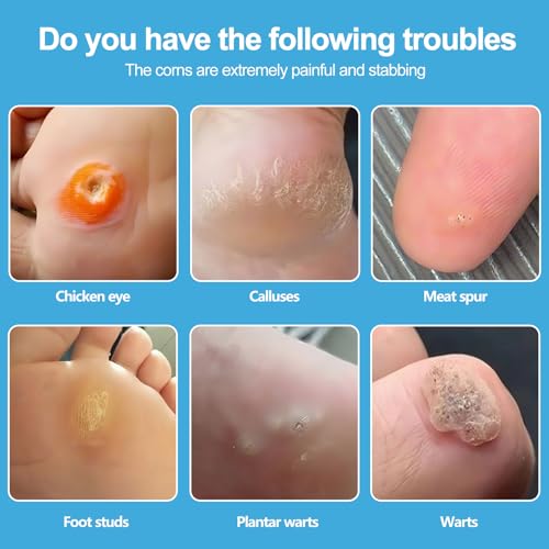 Image of Corn Remover Pads (48 count 2 pack) Plantar Wart Remover for Feet, Corn Removers for Toes with 40% Salicylic Acid, Callus Removal for Feet