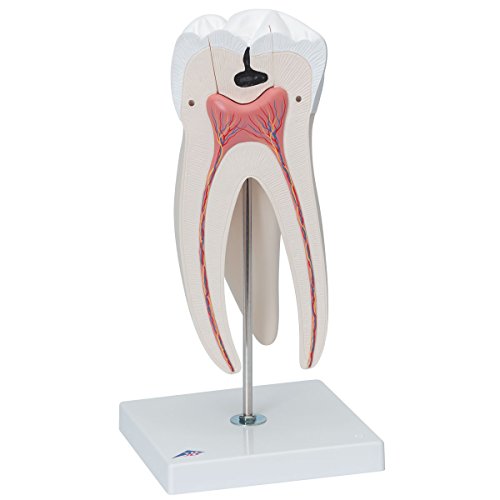 Image of 3B Scientific D15 Giant Molar w / Dental Caries 15x life-size 6-part - 3B Smart Anatomy