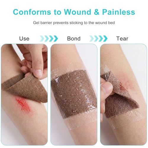 Sliver Calcium Alginate Wound Dressing, 4x4 Inch Gauze Pads (5 Count) | Highly Absorbent Gel-Forming Dressing for Exuding Wounds | Non-Adherent — view 5