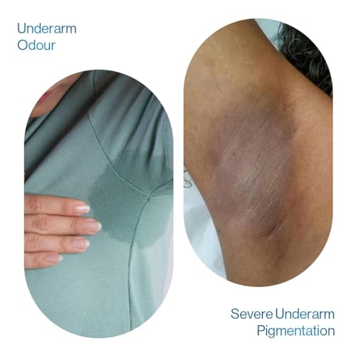 Image of Be Bodywise Advanced Pigmentation Kit | With 6% AHA BHA Flora Underarm Roll-On (75ml) & Pigmentation Repair Cream (100g) | Reduces Body Odor, Fades Pigmentation & Corrects Uneven Skin Tone