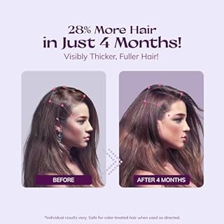 Women's 5% Minoxidil Spray for Hair Growth: 2-Pack RootStim Extra Strength Minoxidil with Rosemary & Biotin for Thinning Hair Regrowth and Fuller Hair - 60ML Each