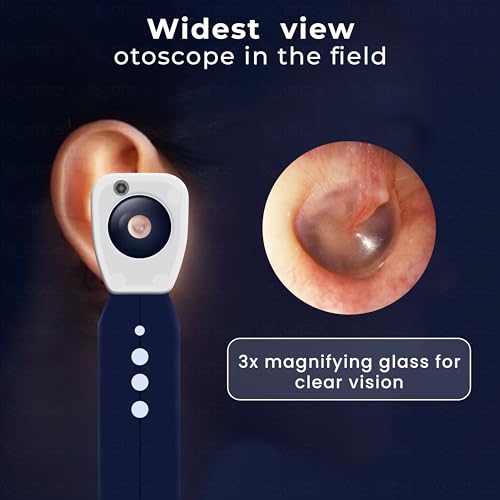 Image of OTICA 3.7V Professional Diagnostic Pocket LED Otoscope | Rechargeable In-Built 3500mAh Battery | Type-C Charging | Adjustable Intensity | 10 Disposable Specula + Spare Glass | 11707 - Blue