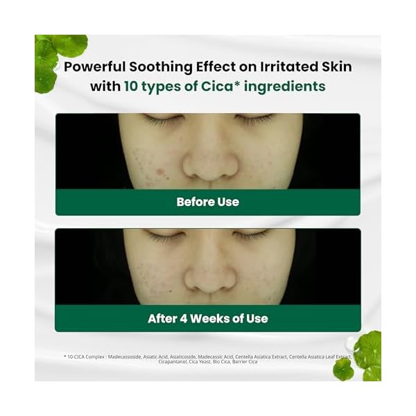 Dr.G Red Blemish Clear Soothing Korean Moisturizer Face Cream, 70ml - Cica Cream, Korean Skin Care Moisturizer, Korean Face Moisturizer, Facial Moisturizer, Korean Skincare, K Beauty Skincare Coreano