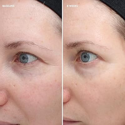 Colorescience Total Eye Firm & Repair Cream, .6 fl. oz.