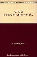 Atlas of Electroencephalography 0316330744 Book Cover