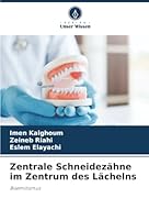 Zentrale Schneidezähne im Zentrum des Lächelns (German Edition) 620893981X Book Cover
