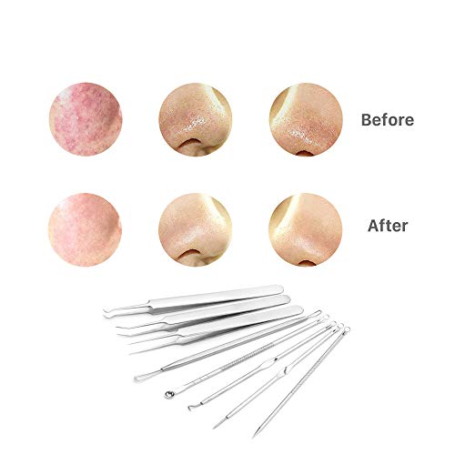 最安値 Pinkiou 毛抜き ピンセット 角栓取り 毛穴ケアキット コメドプッシャー ステンレス 毛穴角栓 粉瘤 にきび取り 黒ずみ取り 鼻ケア 耐酸 防腐 収納ケース付き 携帯便利 8本セット の価格比較