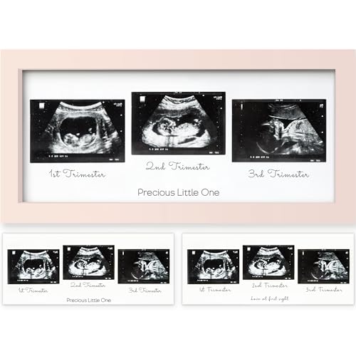 Image of KeaBabies Baby Sonogram Picture Frames - Trio Ultrasound Picture Frames, First Time Mom Gift, Cute Pregnancy Reveal Photo Frame, Baby Gender Reveal Gift, Newborn Nursery Decor (Petal Pink)