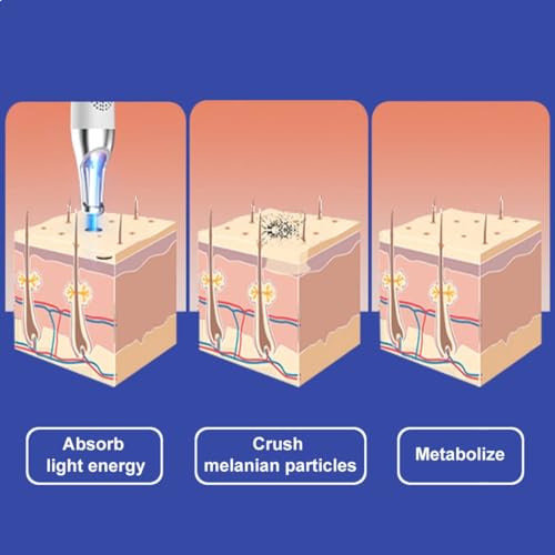 rechargeable red pen with glasses 1 count pack of 1 white