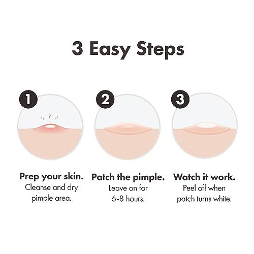 Mighty Patch Original Spot Patches by Hero Cosmetics, Day & Night Time Acne Treatment, Clear Spot Remover Hydrocolloid Patches, Anti Acne Dots, Spot Treatment Pimple Stickers - 36 Patches
