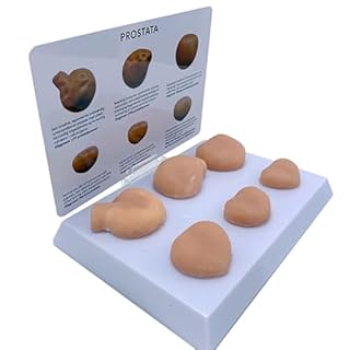 ATJOGWIN Modello di Massa della prostata Set di 6, con Base e Scheda di annotazione