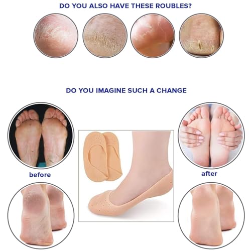 Image of Heel Socks Combo Anti Crack Full Length Silicone Sandal Foot Protector SiliconeSocks for Women, Men Crack Heel Repair Socks, foot spa socks for Women