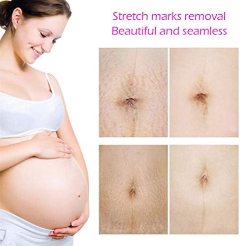 Sunshinehomely TCM Scar Cream, Acne Scar Removal Cream, Skin Repair Scars Burns Cuts Pregnancy Stretch Marks Cream Fat Scar Striae Gravidarum Treatment