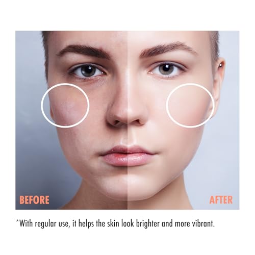 maru.derm Maruderm Vitamin C Serum for Brightening — 10% Sodium Ascorbyl Phosphate, Niacinamide & Panthenol — Serum for the Appearance of Fine Lines, Glow & Dark Spots, 1 fl oz (30 mL)