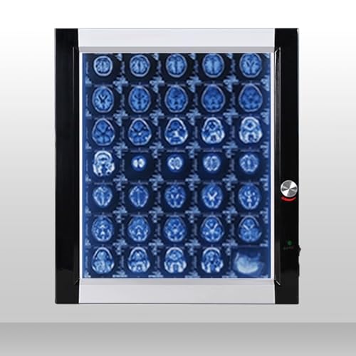 Generic - Boîte Lumineuse D'illuminateur de Film à Rayons X, Lampe de Visualisation Radiologique Murale for Hôpitaux, Activation Automatique du Film