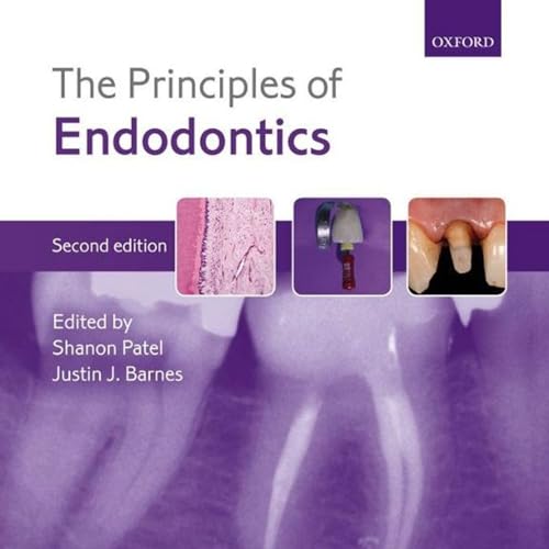 The Principles of Endodontics