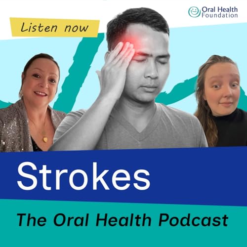 The complicated link between gum disease and strokes