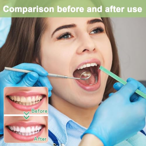 PBAHAUP 4 Bänder Zahn Schleifpapier, Zahn Polierstreifen zur Reinigung der Zahnzwischenräume, Sicher und langlebig für Zahnaufhellung, Einfach anzuwenden