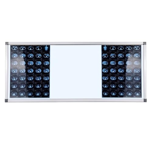 X Ray Led Illuminatorss Wall Mounting View Box Portable X-Ray Led Film Viewer Aluminum Frame and Acrylic Panel X-Ray Viewbox for Clinic and Hospital, Lab Equipment(113x47.5x1.3cm/44.5x18.7x0.5in)
