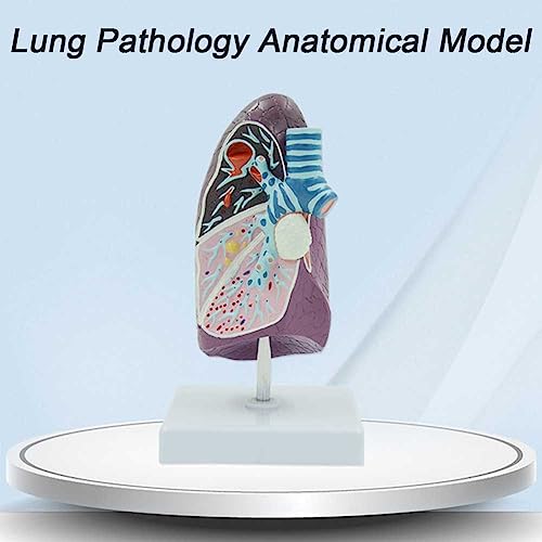 Modèle de poumon fumé pour formation médicale et démonstration des pathologies - 3