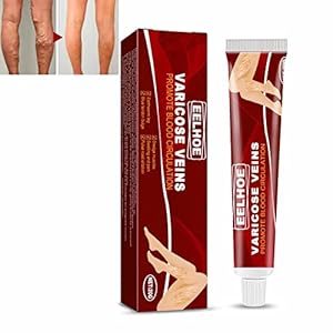 Krampfadern Creme, AFFO Varicose Veins Creme gegen Besenreiser, Varicose Veins Creme gegen Besenreiser, Beine Care Salbe, 20g