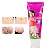 Cicatrices Tratamiento,Crema Anti-Estrías Eliminar Las Estrías Aceite Crema de Estrías para Las Piernas de Las Mujeres, Eliminación de Cicatrices de Estómago Endurecer la Crema