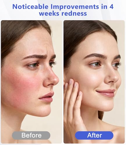 LED Light Therapy Machine FDA Cleared Red, Infrared and Blue Light Therapy, LED Face Mask Light Therapy Skin Care Photon Device for Wrinkle Reduction and Acne, G3 — view 4
