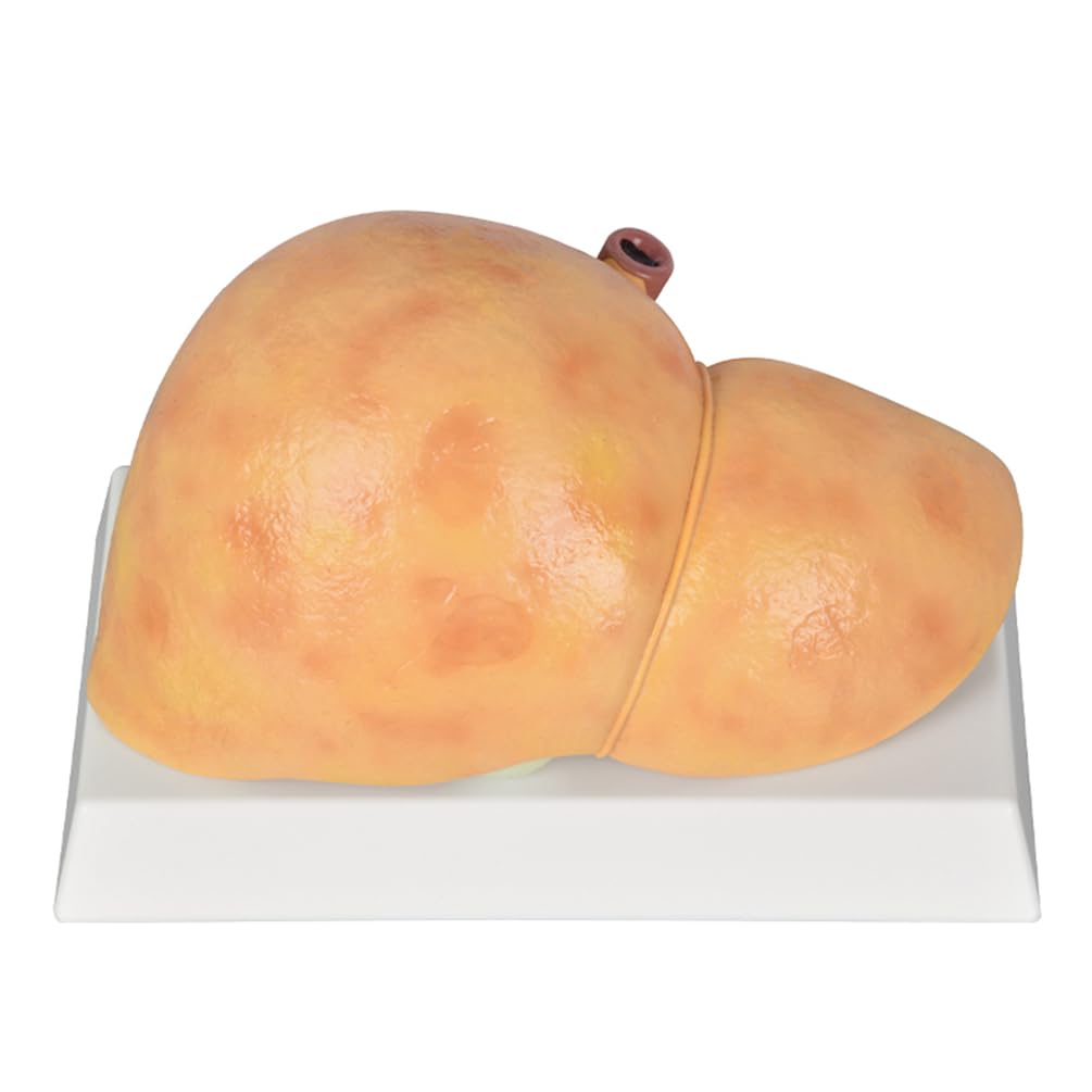 YRQMGSF Adult Normal Liver Model - Pathological Whole Liver Model - Silicone Human Internal Organs for Medical Research and Teaching