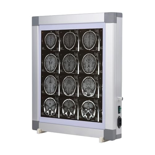 Boîte Lumineuse D'illuminateur de Film à Rayons X Portable, Négatoscope for Équipement Médical Orthopédique à Luminosité Réglable