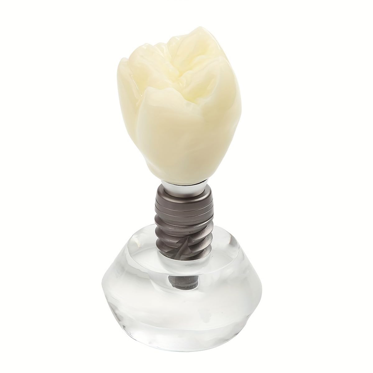Dental Clear Implant Model Detail Implant Demonstration Detachable Crystal Crown Typodont Structure for Training and Education