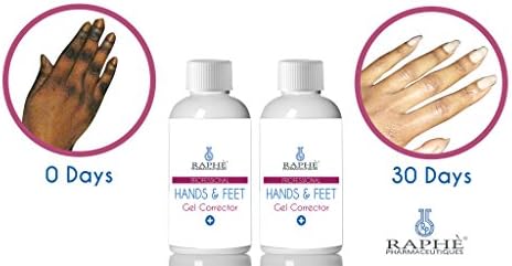 Pre-neutralized: 2 Bottles Of Hands N Feet Gell Corrector For Hydroquinone Damaged Digits. A 7 DAY Bleaching Peel For Hands & Feet Previously Damaged By Hydroquinone Products 30ml each/ 60ml Both