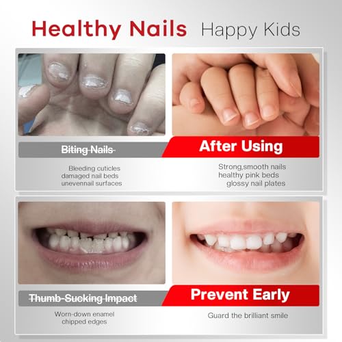 Glamonade Nail Biting Prevention For Kids: 12ml Extra Bitter No Bite Nail Polish Thumb Sucking Deterrent 48H Long-Lasting Matte Clear Strength Nail Repair for Damaged Nails Care & Habit Breaker Aid
