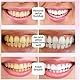 Sp-6 Toothpaste Fluoride-Free Enamel Protection Sensitive Teeth, SP6 Probiotics Zahnpasta, SP-6 Probiotic Whiten Toothpaste, Fresh Mint Flavor Whitening Toothpaste Sp-6 (1Pc)