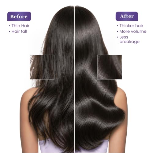 Image of Parachute Advansed Rosemary - Long and Strong Hair Oil | With Pure Coconut Oil | Nourishment for Growth & Strength 170ml