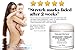 Natural Riches Stretch Marks & Scar Removal Cream, from Natural Riches - Natural, Reduces the Appearances of Stretch Marks and scars - 4 oz
