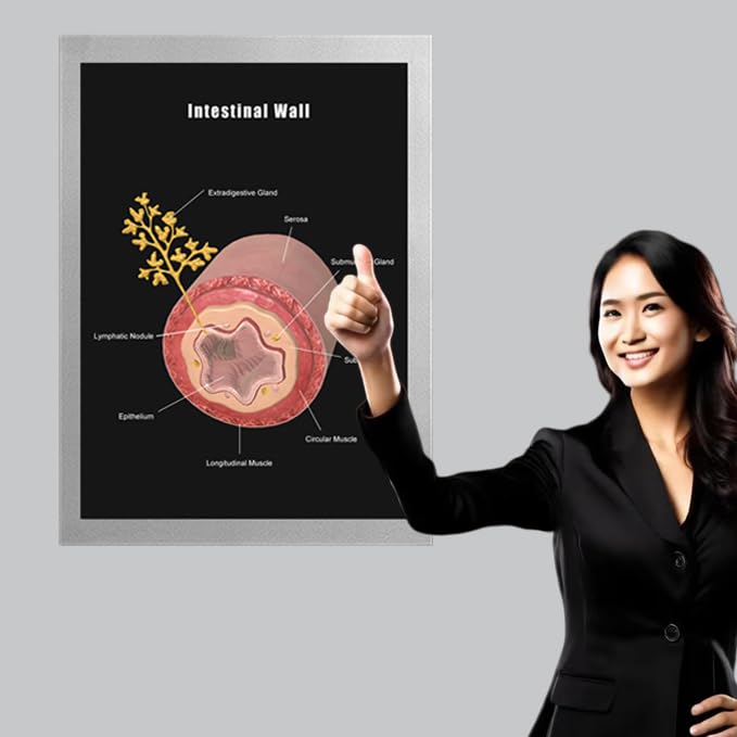 Image of Taanfu Body Educational Learning Anatomy Posters ，Intestine Wall Art Intestinal Villi Anatomy Art Poster Digestive System Organs Illustration Small Intestine Physiology Anatomy Wall Art Villi