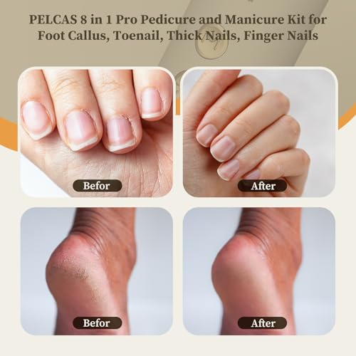 PELCAS 8 in 1 Cordless Nail Drill, Electric Nail Filer 5 Speeds & LED Light Alternate view