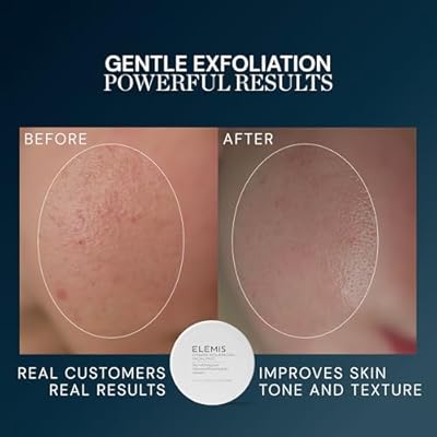 ELEMIS Dynamic Resurfacing Facial Pads, Gentle Textured Treatment Facial Exfoliating Pads