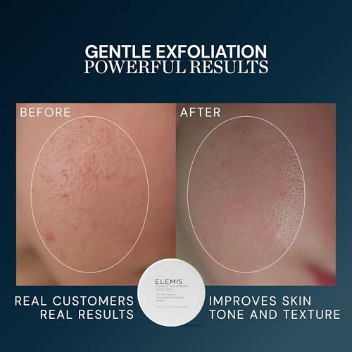 Image of ELEMIS Dynamic Resurfacing Facial Pads, Gentle Textured Treatment Facial Exfoliating Pads
