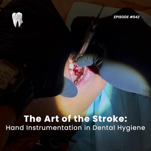 542 The Art of the Stroke: Hand Instrumentation in Dental Hygiene