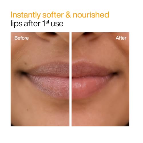 Image of WishCare Lip Balm Combo (Tinted & Untinted) | With Kojic Acid & Niacinamide | Hydrating & Brightening Lip Care | Heals Dry Lips, Reduces Pigmentation & Adds Soft Tint | For Smooth, Even-Toned Lips