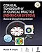 Corneal Tomography in Clinical Practice (Pentacam System): Basics and Clinical Interpretation