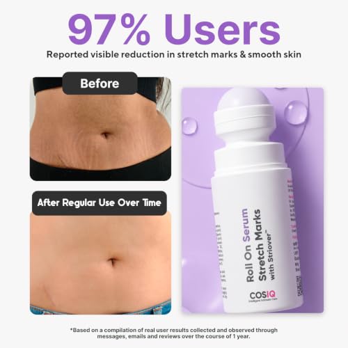 Image of CosIQ Roll On Serum for Stretch Marks with Striover | Reduces Appearance of Stretch Marks, Scars & Uneven Skin | Roll-On Applicator for Stomach, Thighs & Hips | All Skin Types | 40ml, Pack of 2