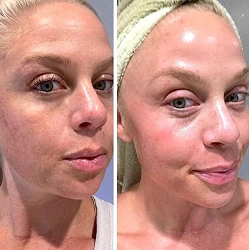 Miniatura 3 de Gel de retinol 0.1 Vitamina A repara líneas finas y arrugas, tratamiento de cicatrices, edad y manchas solares, gel de fórmula antienvejecimiento