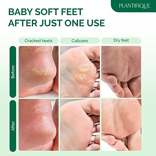 Foot Peel Mask Foot For Men - Mask Dermatologically Tested - Repairs Heels & Removes Dry Dead Skin For Baby Soft Feet - Exfoliating Foot Peel Mask For Dry Cracked Feet #TOP2