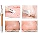 TAROMAING 5pcs Professional Wooden Exfoliating Facial Cleansing Brushes Nose Skin Care Scrub Pore Blackhead Whitehead Cleaner Tools …
