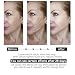 Imagen de Masajeador Facial Antiarrugas con Luz LED 7 Colores