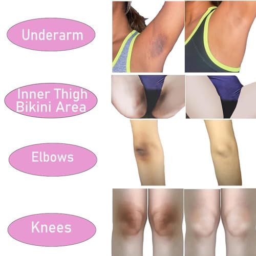 Image of Yana Beauty Private Parts whitening & Brightening Night Cream For women