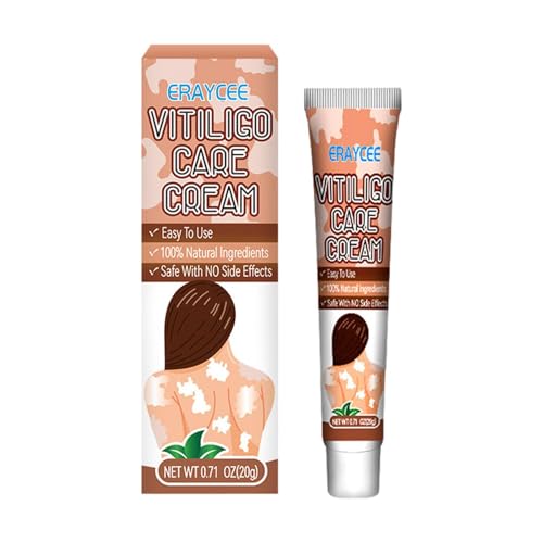 Crema Per La Cura Della Vitiligine, 20 G Di Crema Per Sollievo Dalla Vitiligine, Per Macchie Bianche Sulla Pelle,da Applicare Per Macchie Bianche Sulla Pelle Migliora I
